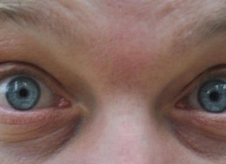 De blog van Peter D'Herde